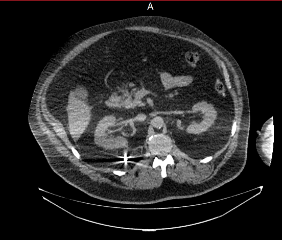 инородные 5