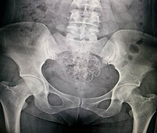 инородные10